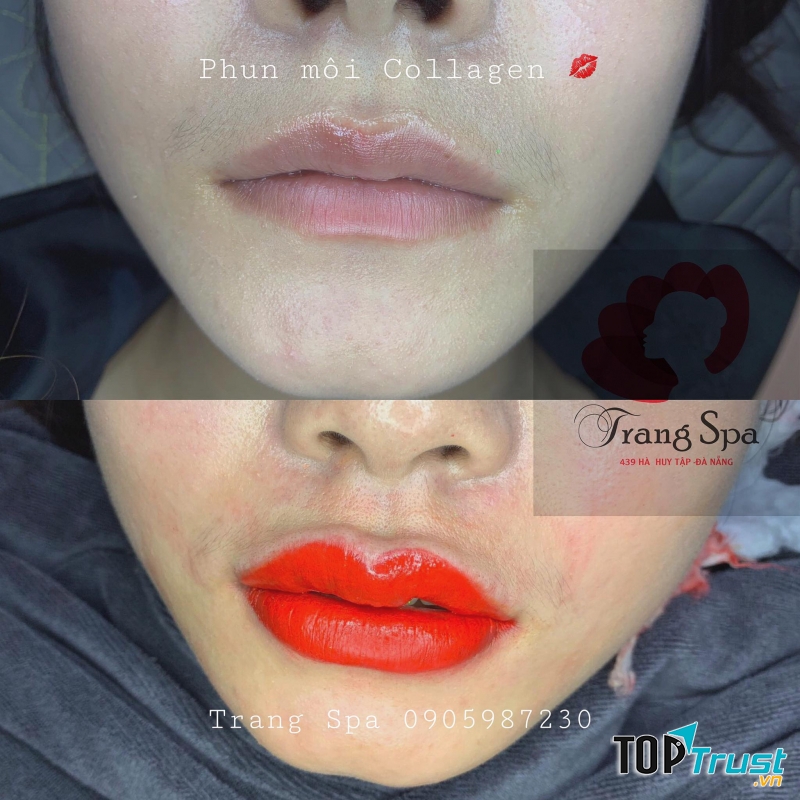 Spa Trang - Đà Nẵng