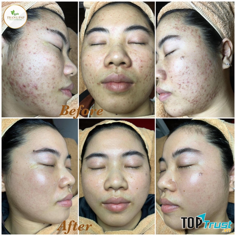 Spa TRANG PAP Bình Dương