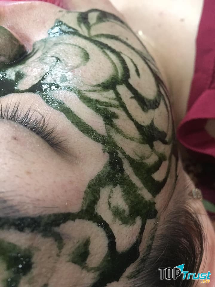 Trị liệu tại spa VYVy