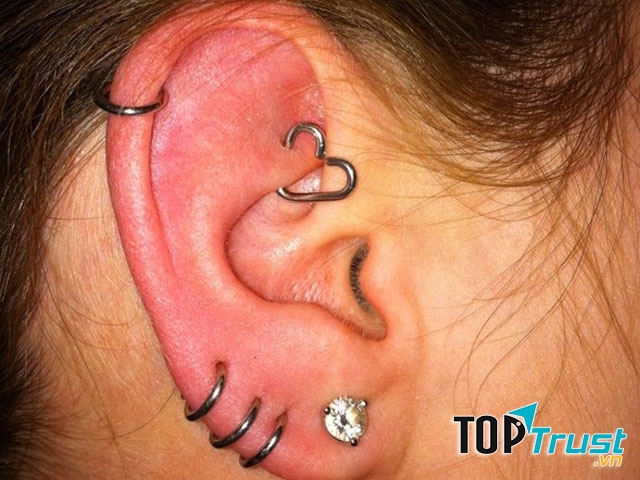 Xỏ khuyên tai quá lớn, nhiều