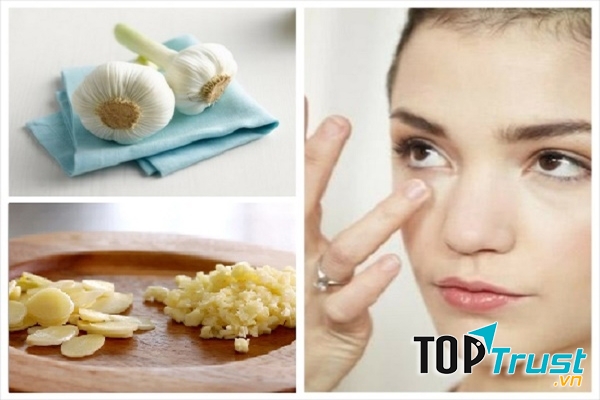 Triệt tiêu mụn với những củ tỏi đáng yêu