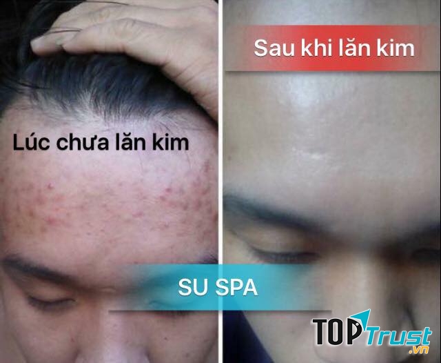 SU SPA