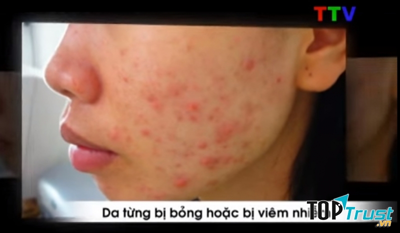 SỰ THAY ĐỔI CỦA DA