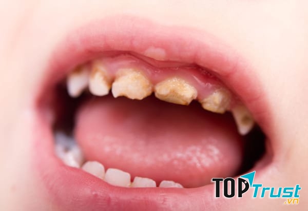 Ảnh minh họa - nguồn internet