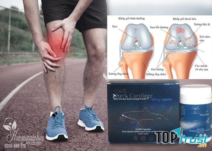 ﻿Hỗ trợ xương khớp Sụn vi cá Mập Aussia Shark Cartilage 750mg 180 viên: