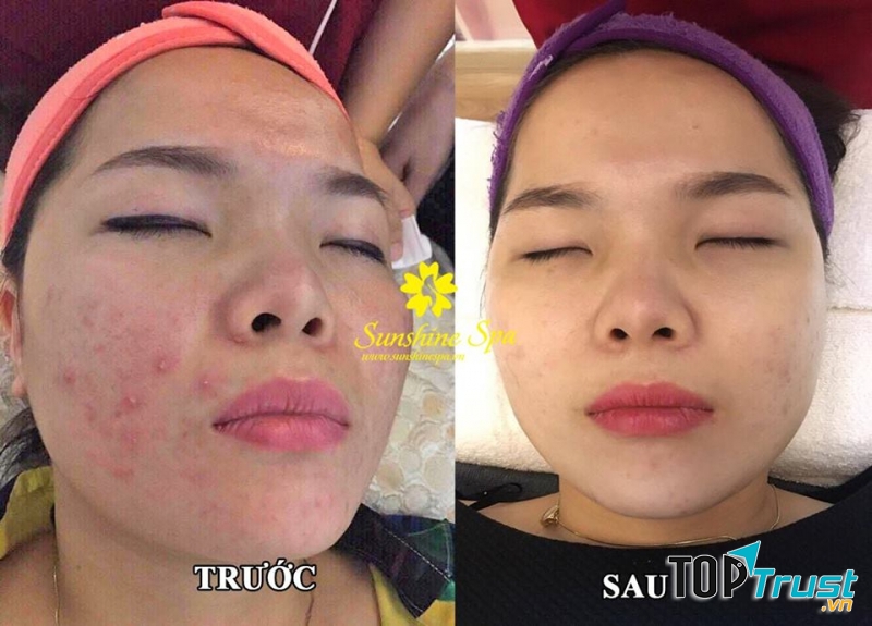 Sunshine Spa - Spa Đông Y