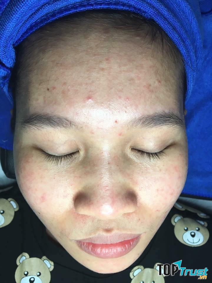 Suwan spa