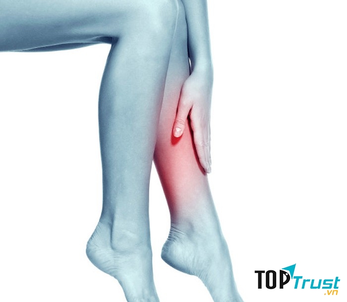 Suy giãn tĩnh mạch và liên hệ trực tiếp đến ung thư