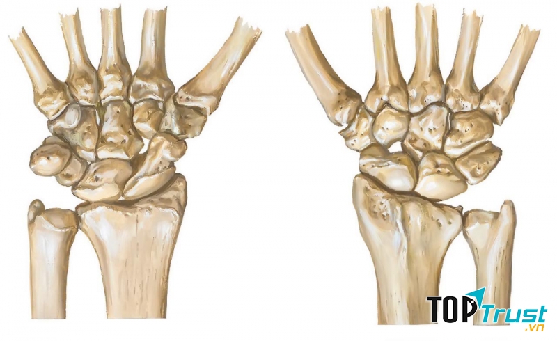 Đu đủ giúp tăng hàm lượng calci có trong xương