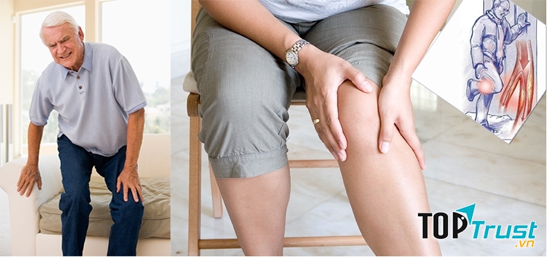 Tăng nguy cơ mắc bệnh Gout