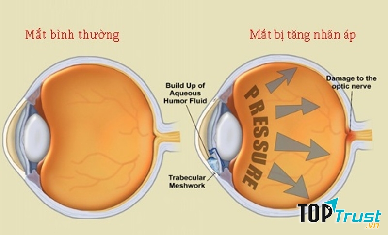 Ảnh minh họa (Nguồn Internet)