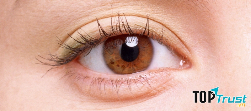 Ảnh minh họa (Nguồn Internet)