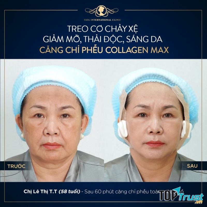TATA International Clinic