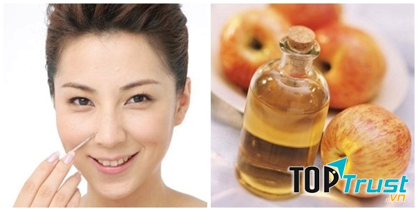 Giấm táo tẩy da chết, làm trắng da cấp tốc