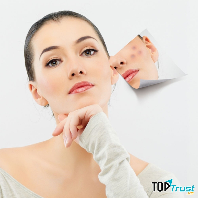 Mỗi tuần bạn nên tẩy tế bào chết từ 1 đến 2 lần để loại bỏ một số vi khuẩn gây hại trên da.