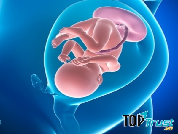 Thai thiếu oxy cũng dễ bị chết lưu hoặc chậm phát triển