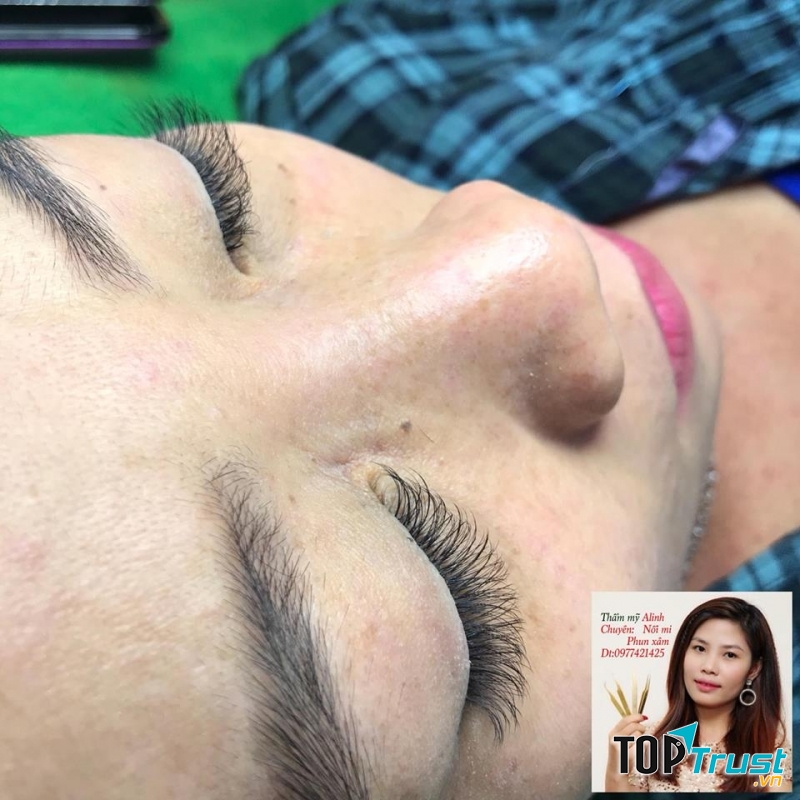 Thẩm mỹ Alinh