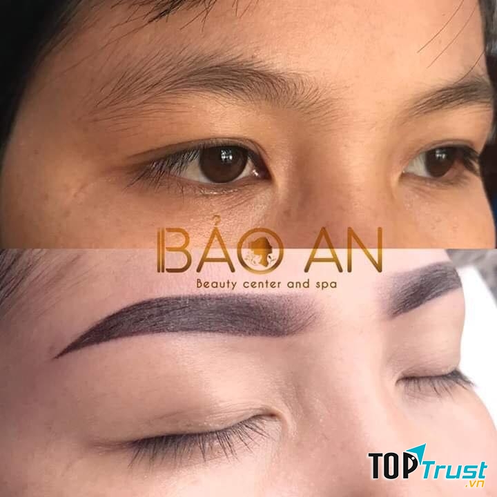 Thẩm mỹ Bảo An