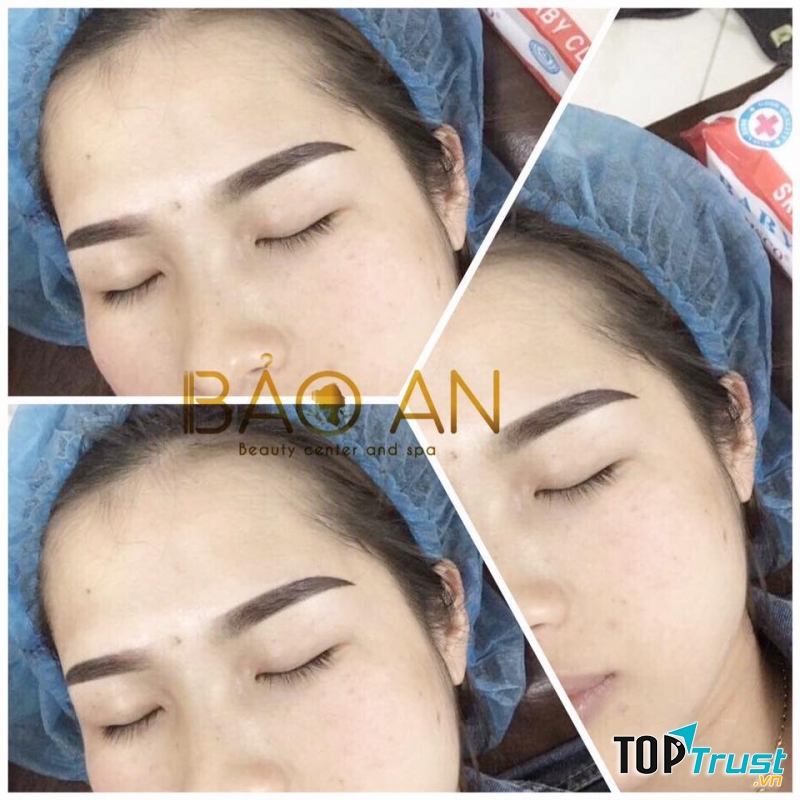 Thẩm mỹ Bảo An