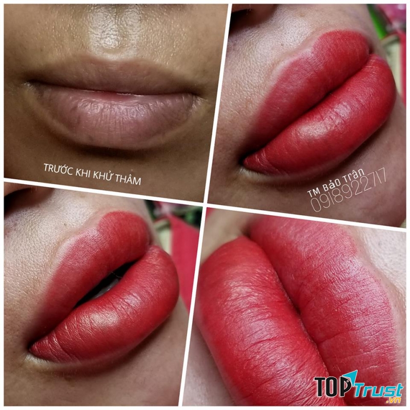 Thẩm Mỹ Bảo Trân