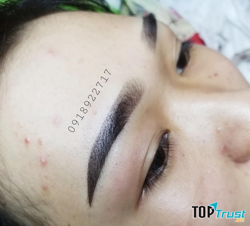 Thẩm Mỹ Bảo Trân