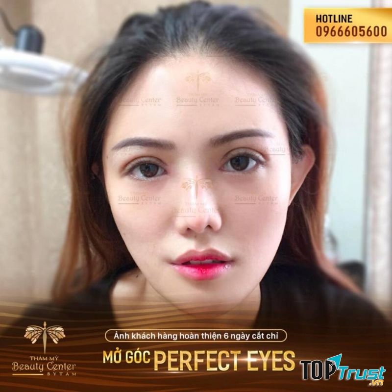 Thẩm Mỹ Beauty Center - By Tấm