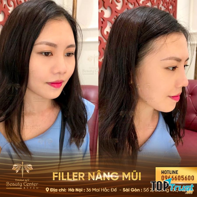 Thẩm Mỹ Beauty Center - By Tấm