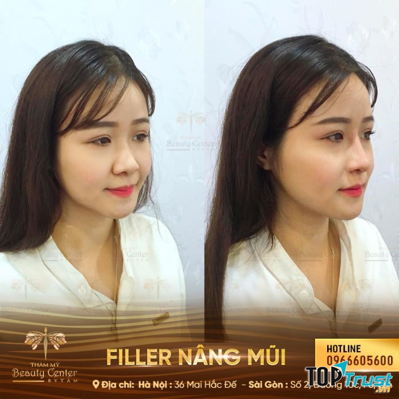 Thẩm Mỹ Beauty Center - By Tấm