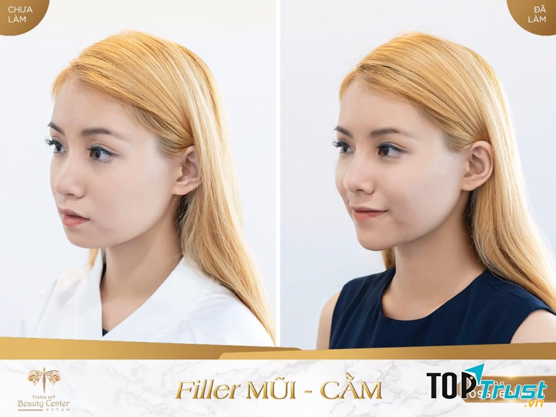 Thẩm Mỹ Beauty Center By Tấm