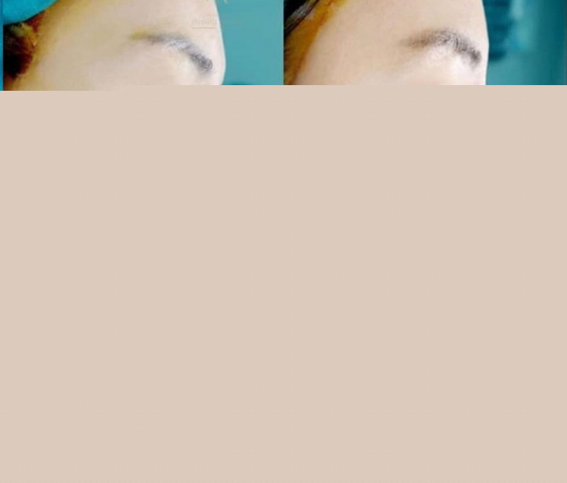 Thẩm mỹ Beauty Center – by Tấm