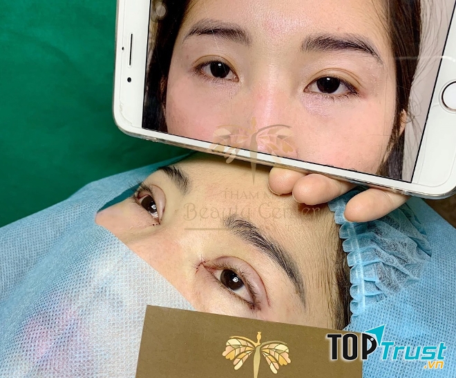 Thẩm mỹ Beauty Center – by Tấm