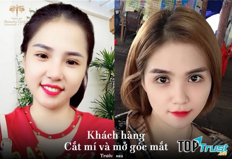 Thẩm mỹ Beauty Center – by Tấm