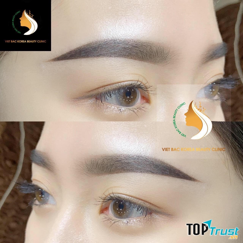 Thẩm Mỹ Bệnh Viện Việt Bắc I