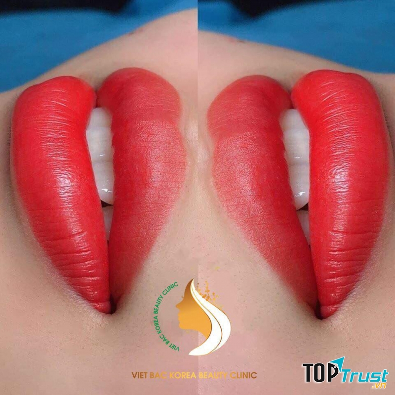 Thẩm Mỹ Bệnh Viện Việt Bắc I