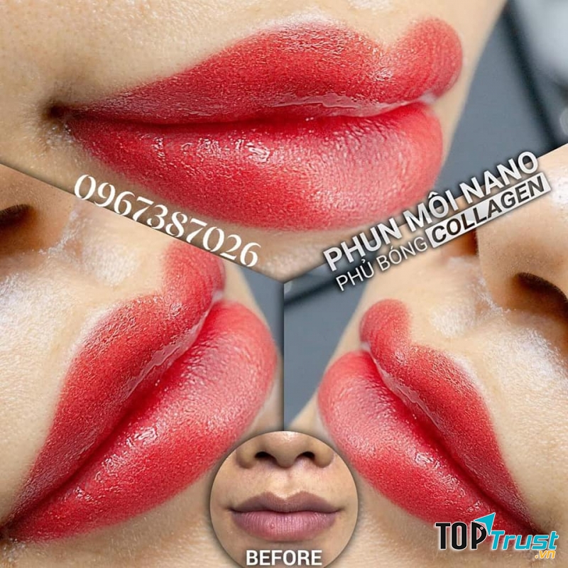 Thẩm Mỹ Bích Hằng