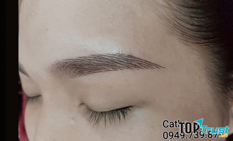 Thẩm mỹ Cathy Nha Trang