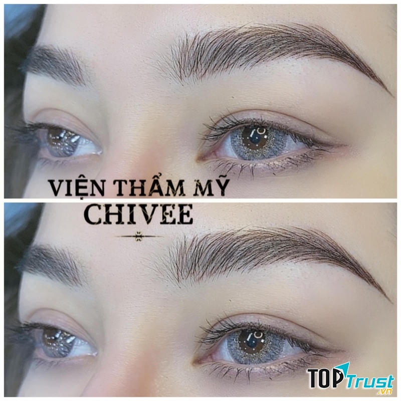 Thẩm mỹ CHI VEE