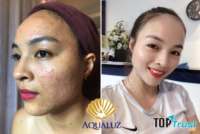Thẩm Mỹ Công Nghệ Cao Aqualuz