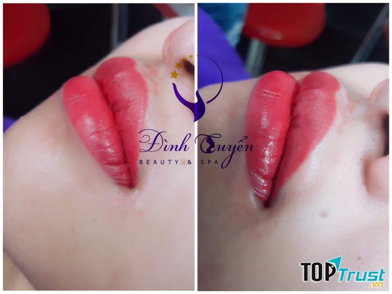 Phun mày tán bột tại thẩm mỹ Đình Tuyển