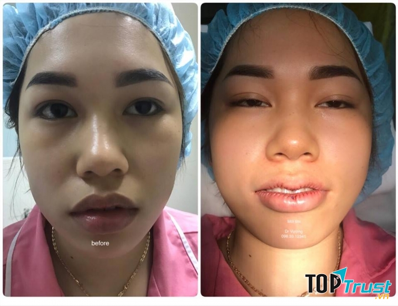 Thẩm mỹ Dr Vương