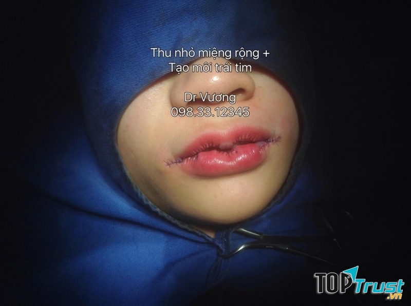 Thẩm mỹ Dr Vương