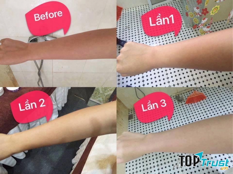 Hiệu quả các lần tắm trắng tại Emmy spa