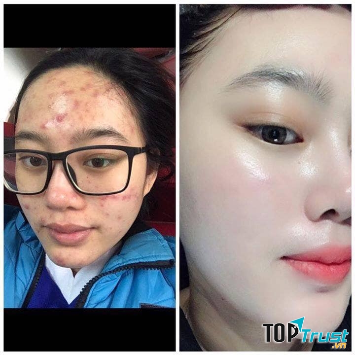 Thẩm Mỹ Emmy Huế