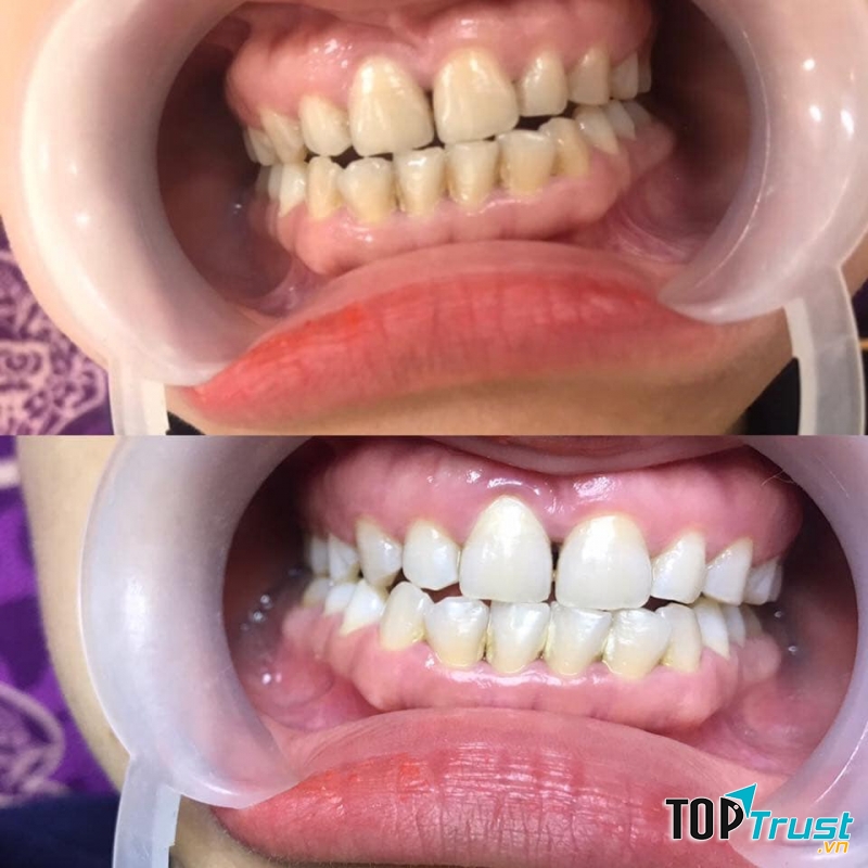 Thẩm Mỹ Emmy Quảng Ngãi