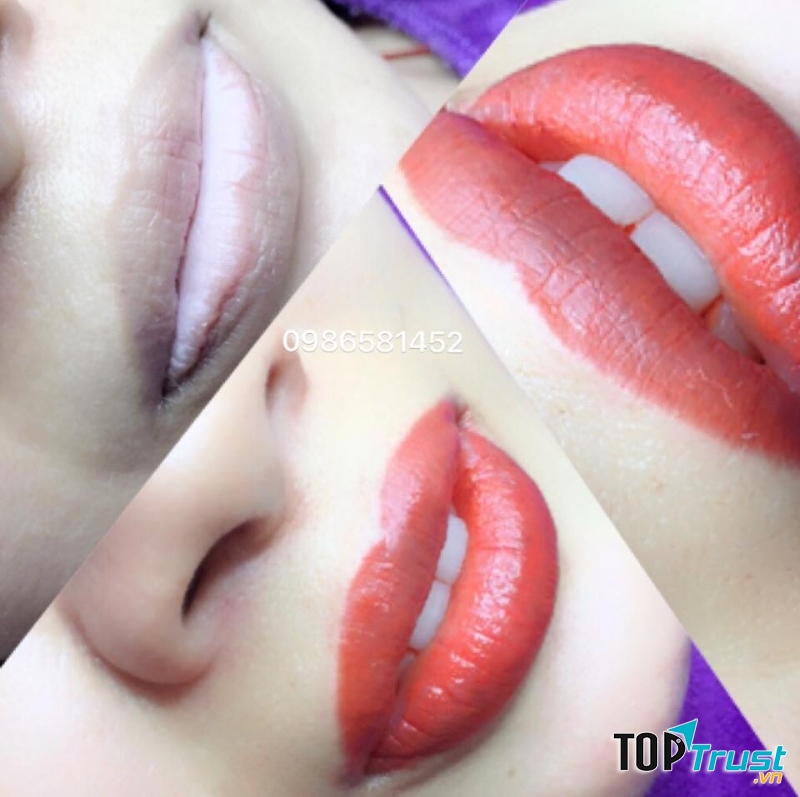 Một mẫu môi rất đẹp được làm tại thẩm mỹ Hà Đàm