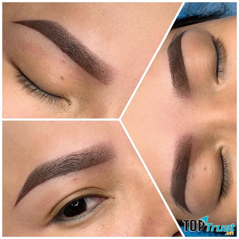 Thẩm Mỹ Hải Băng