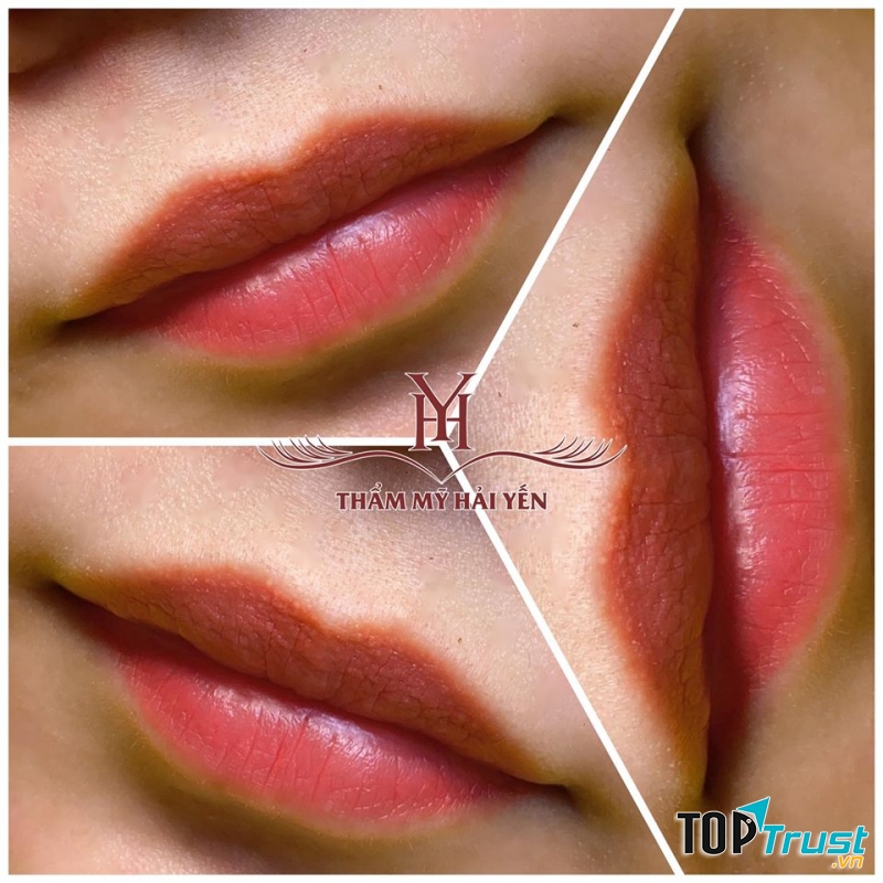 Phun xăm màu môi tại Thẩm mỹ Hải Yến
