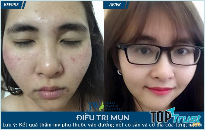 Thẩm mỹ Hàn Quốc JW