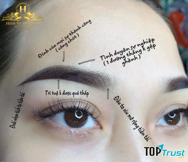 Thẩm Mỹ Hiền Vy