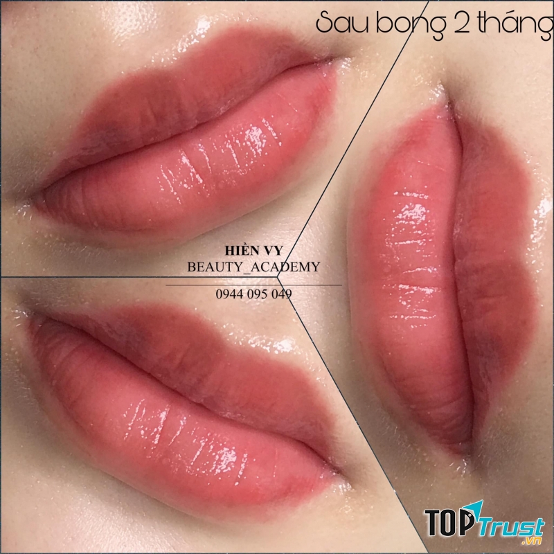 Thẩm Mỹ Hiền Vy